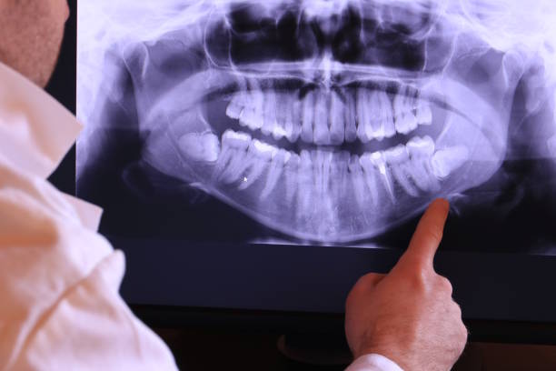 Best Broken or Cracked Tooth Emergency Dentist in Belleair, FL